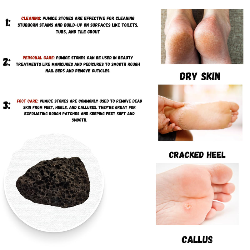 TAJ Pumice Stone for feet Pumice Stone for Toilet Hard Skin Remover Foot Foot File Natural Salt Organic Callus Remover for feet Callus Remover Foot mask (Lava Pumice)