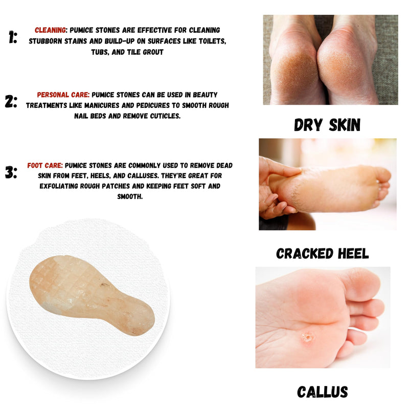 TAJ Pumice Stone for feet Pumice Stone for Toilet Hard Skin Remover Foot Foot File Natural Salt Organic Callus Remover for feet Callus Remover Foot mask (Lava Pumice)
